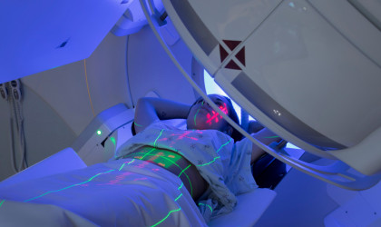 Νέα μέθοδος ακτινοθεραπείας για τον καρκίνο από τις ΗΠΑ -Τι αλλάζει