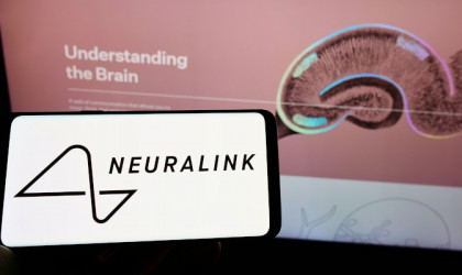 Ο κόσμος «συρρέει» για το εμφύτευμα της Neuralink και ο Μασκ μαζεύει «ζεστό χρήμα» για τις δοκιμές