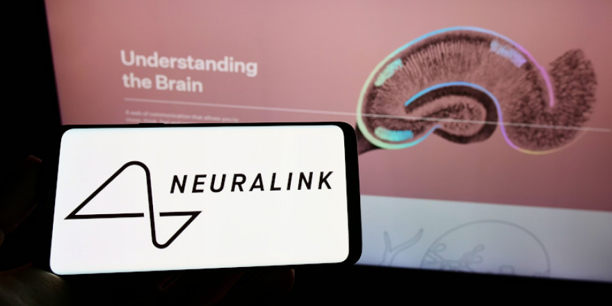 Ο κόσμος «συρρέει» για το εμφύτευμα της Neuralink και ο Μασκ μαζεύει «ζεστό χρήμα» για τις δοκιμές